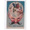 SURREALISME PHOTOMONTAGE : le cerveau de l'homme aux rayon X (alcool - tabac - jeux - femmes)- très bon état